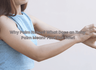 What Does an Itchy Palm Mean? Find Out Now!